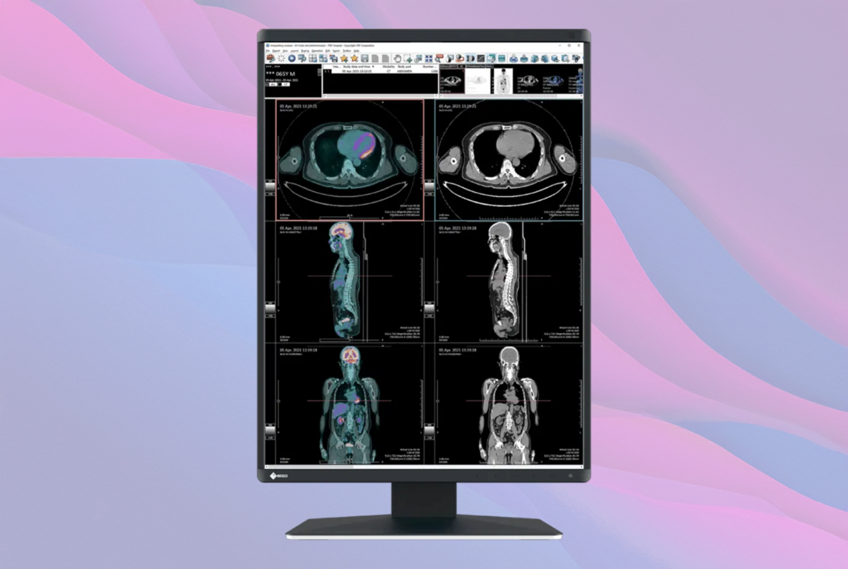 EIZO RadiForce RX370